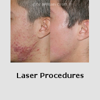Before and After Gallery - Lasers